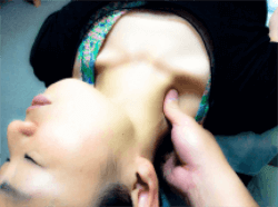 リンパ液 / リンパ節の役割